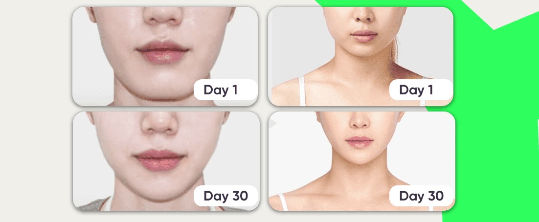 How to Relax Your Masseter Muscle: Tips for a Softer Jawline